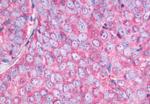 NMBR Antibody in Immunohistochemistry (Paraffin) (IHC (P))