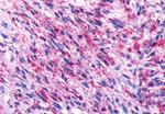 NPBWR2 Antibody in Immunohistochemistry (Paraffin) (IHC (P))