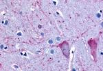 NPBWR2 Antibody in Immunohistochemistry (Paraffin) (IHC (P))