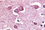 NPBWR2 Antibody in Immunohistochemistry (Paraffin) (IHC (P))