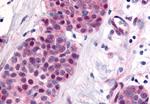 TLX Antibody in Immunohistochemistry (Paraffin) (IHC (P))