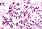 EAR2 Antibody in Immunohistochemistry (Paraffin) (IHC (P))