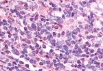 EAR2 Antibody in Immunohistochemistry (Paraffin) (IHC (P))