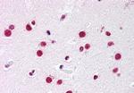 NR5A1 Antibody in Immunohistochemistry (Paraffin) (IHC (P))