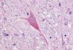 NTSR1 Antibody in Immunohistochemistry (Paraffin) (IHC (P))