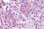 OR2A4 Antibody in Immunohistochemistry (Paraffin) (IHC (P))