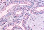 OR51E1 Antibody in Immunohistochemistry (Paraffin) (IHC (P))