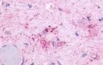 OR51E1 Antibody in Immunohistochemistry (Paraffin) (IHC (P))