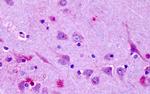 OR6N1 Antibody in Immunohistochemistry (Paraffin) (IHC (P))