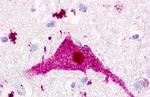 P2Y1 Antibody in Immunohistochemistry (Paraffin) (IHC (P))