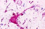 P2Y1 Antibody in Immunohistochemistry (Paraffin) (IHC (P))