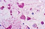 P2Y1 Antibody in Immunohistochemistry (Paraffin) (IHC (P))