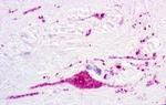 P2Y1 Antibody in Immunohistochemistry (Paraffin) (IHC (P))