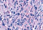 P2Y11 Antibody in Immunohistochemistry (Paraffin) (IHC (P))