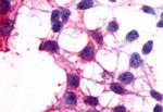 P2Y12 Antibody in Immunocytochemistry (ICC/IF)