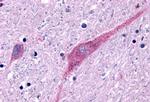 P2Y13 Antibody in Immunohistochemistry (Paraffin) (IHC (P))