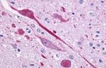 P2Y14 Antibody in Immunohistochemistry (Paraffin) (IHC (P))