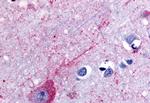 P2Y14 Antibody in Immunohistochemistry (Paraffin) (IHC (P))