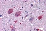 P2Y14 Antibody in Immunohistochemistry (Paraffin) (IHC (P))