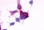 P2Y6 Antibody in Immunocytochemistry (ICC/IF)