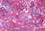 P2Y6 Antibody in Immunohistochemistry (Paraffin) (IHC (P))