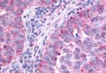 PAK6 Antibody in Immunohistochemistry (Paraffin) (IHC (P))