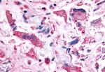 PAK6 Antibody in Immunohistochemistry (Paraffin) (IHC (P))