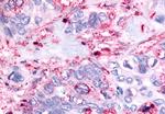 PAK6 Antibody in Immunohistochemistry (Paraffin) (IHC (P))