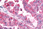 PAK6 Antibody in Immunohistochemistry (Paraffin) (IHC (P))