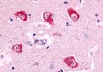 PAK7 Antibody in Immunohistochemistry (Paraffin) (IHC (P))