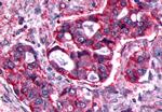 PTGFR Antibody in Immunohistochemistry (Paraffin) (IHC (P))