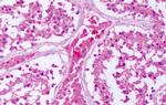 PTPRE Antibody in Immunohistochemistry (Paraffin) (IHC (P))