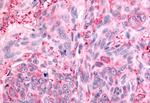 PTPRE Antibody in Immunohistochemistry (Paraffin) (IHC (P))