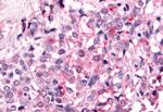 PTPRE Antibody in Immunohistochemistry (Paraffin) (IHC (P))