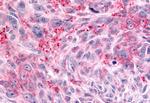 PTPRE Antibody in Immunohistochemistry (Paraffin) (IHC (P))