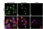 RORA Antibody in Immunocytochemistry (ICC/IF)