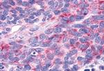 RORA Antibody in Immunohistochemistry (Paraffin) (IHC (P))