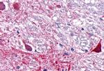 RORA Antibody in Immunohistochemistry (Paraffin) (IHC (P))