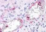 ROR gamma Antibody in Immunohistochemistry (Paraffin) (IHC (P))