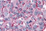 ROR gamma Antibody in Immunohistochemistry (Paraffin) (IHC (P))