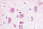 RXFP3 Antibody in Immunohistochemistry (Paraffin) (IHC (P))