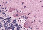 SCN1A Antibody in Immunohistochemistry (Paraffin) (IHC (P))