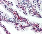 SLC39A6 Antibody in Immunohistochemistry (Paraffin) (IHC (P))