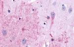 TACR3 Antibody in Immunohistochemistry (Paraffin) (IHC (P))