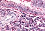 TBXA2R Antibody in Immunohistochemistry (Paraffin) (IHC (P))