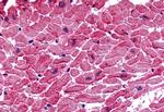 TPRA1 Antibody in Immunohistochemistry (Paraffin) (IHC (P))