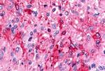 TPRA1 Antibody in Immunohistochemistry (Paraffin) (IHC (P))