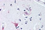 WNT8B Antibody in Immunohistochemistry (Paraffin) (IHC (P))