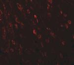 TSHZ3 Antibody in Immunohistochemistry (IHC)