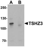 TSHZ3 Antibody in Western Blot (WB)